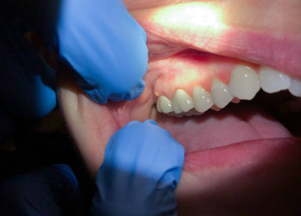 Best Broken Tooth Emergency  in Lynchburg, TN