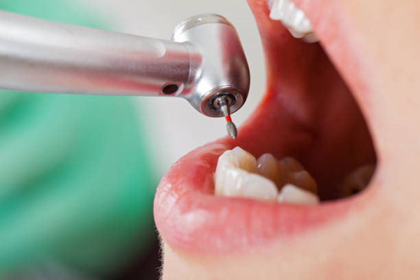 Best Root Canal Emergency Dentist  in Lynchburg, TN